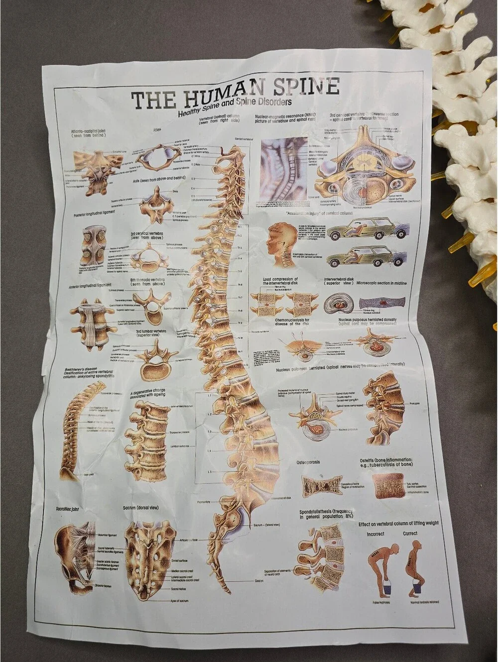 Life Size Flexible Human Spine Anatomical Model w/Stand Poster Open Box Complete